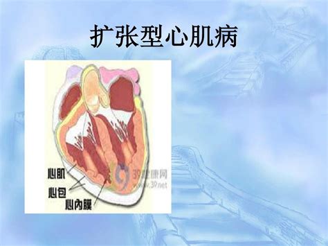 扩张型心肌病查房word文档在线阅读与下载无忧文档