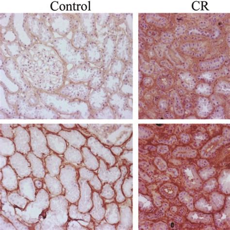 Staining Areas Mean Sem For Collagen Col I A And Collagen Iii