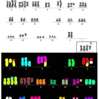 Results of FISH for other derivative chromosomes. Each + represents a ...