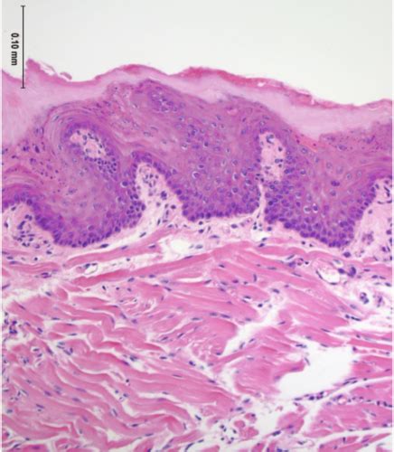 8 Histo Oral Cavity Flashcards Quizlet