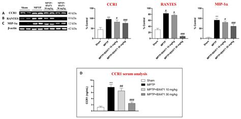 Ijms Free Full Text Novel Findings On Ccr1 Receptor In Cns