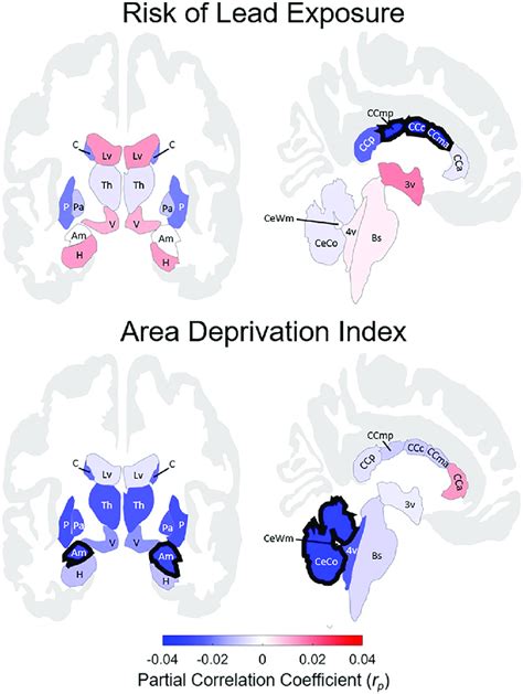 Regional Associations Between Subcortical Volume And Risk Of Lead