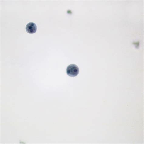 Entamoeba histolytica, Smear Microscope Slides | Carolina Biological Supply