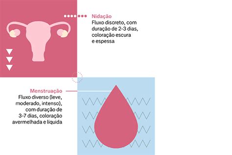 Nida O O Que Sintomas E Quando Ocorre O Sangramento Nav Dasa