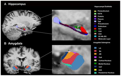 An Example Of Amygdala A And Hippocampal B Segmentation In A