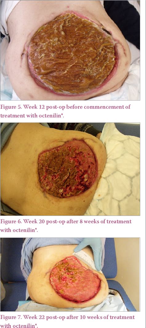 Figure 5 From An Evaluation Of The Efficacy And Cost Effectivness Of