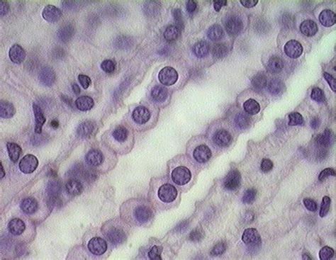 Stratified Squamous Epithelium 100x