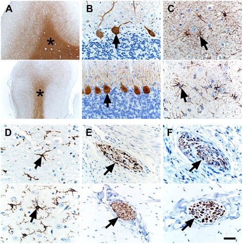 Immunohistochemical Markers For Prospective Studies In