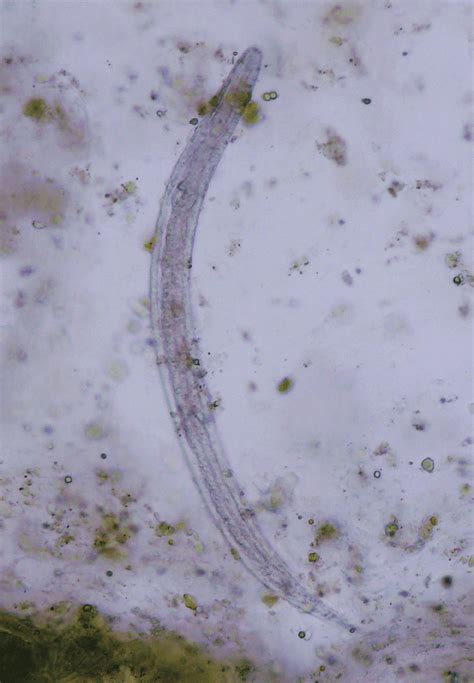 A Rhabditoid Larva Of Strongyloides Stercoralis Visible In The Stool Download Scientific