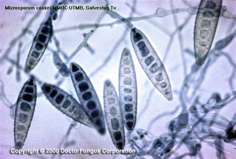 Microsporum cookei - Doctor Fungus