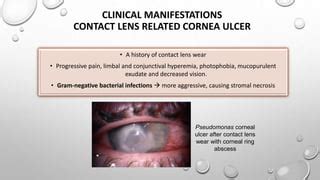 Ppt Contact Lens Induced Corneal Ulcer Pptx