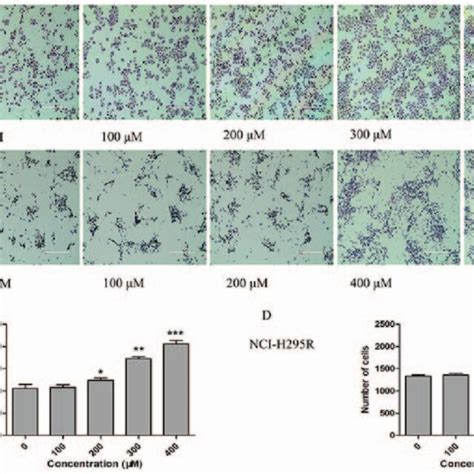 TUDCA Promotes The Invasiveness Of SW 13 And NCI H295R Cells After 24