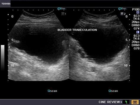 A Gallery Of High Resolution Ultrasound Color Doppler And 3d Images