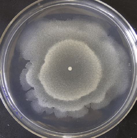 Endospore Formers Bacillus And Clostridium Flashcards Quizlet