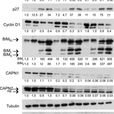 Calpain Knockdown Enhances 17AGG Induced Downregulation Of HSP90