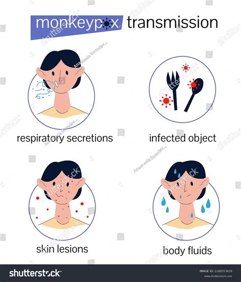 Transmission Monkeypox Information Poster Infographics Character Stock ...