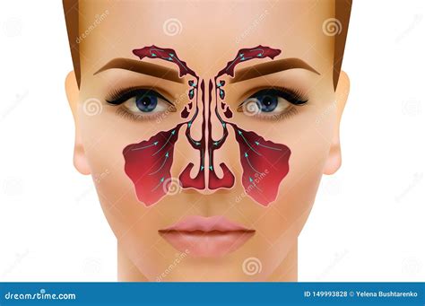 Sinusitis Healthy And Sinus Infections Signs Realistic Illustration