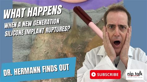 What Happens When New Generation Silicone Implants Rupture Youtube