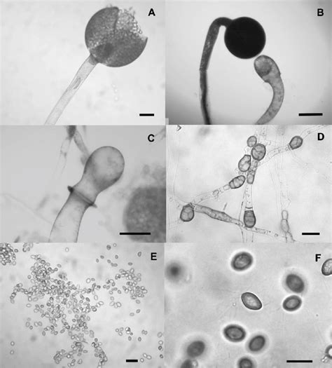 Gilbertella Persicaria A Sporophore With Mature Sporangia B