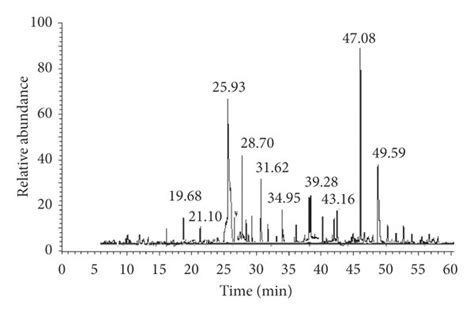 Gc Ms Ms Chromatogram Of Ethanol Stem Extract Of R Raetam Download