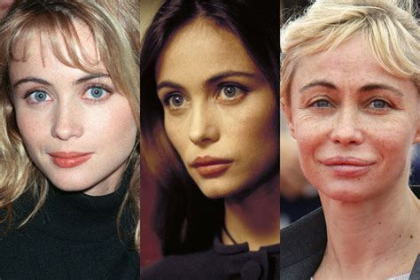 Chatter Busy: Emmanuelle Beart Plastic Surgery