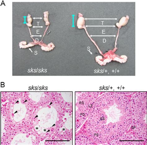 Male Gonads Of Sks And Normal Mice A External Appearances Of Testis