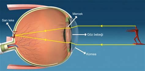 Astigmat Nedir Kpss G Ncel Bilgiler