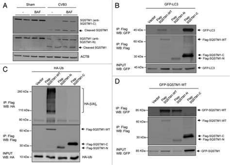 Full Article Cleavage Of Sequestosome 1 P62 By An Enteroviral Protease