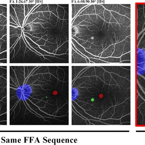 Representative Segmentation Results Of The Proposed Method Four Download Scientific Diagram