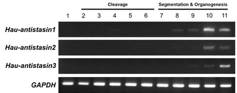 Images Of Ethidium Bromide Stained Agarose Gels Showing Replicated