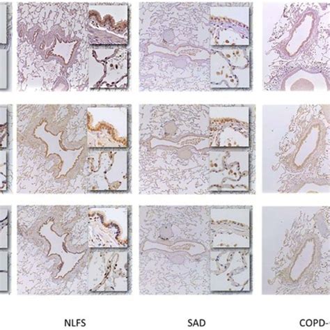 Micrographs Of ACE2 Furin And TMPRSS2 Protein Expression In The Small