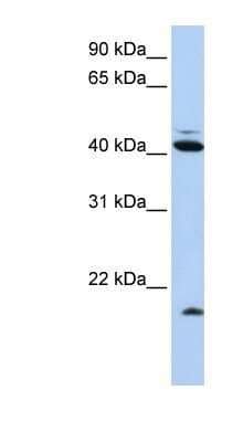 FAT10 Antibody NBP1 58337 Novus Biologicals