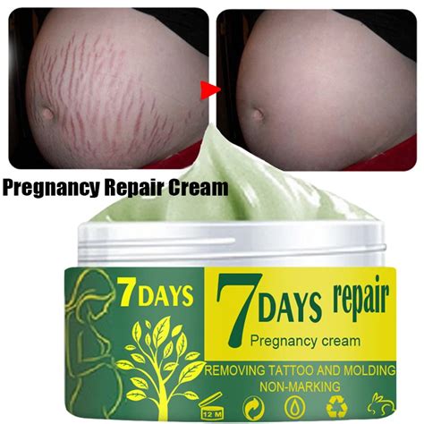 Maternity Scars Acne Cream Pregnancy Stretch Marks Remove Cream Remove