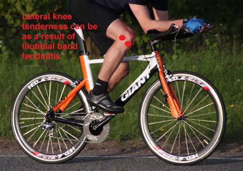 Cycling Knee Pain Causes Symptoms And Treatment Hubpages