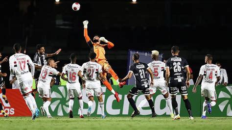 Santos x Inter de Limeira Saiba onde assistir e as prováveis