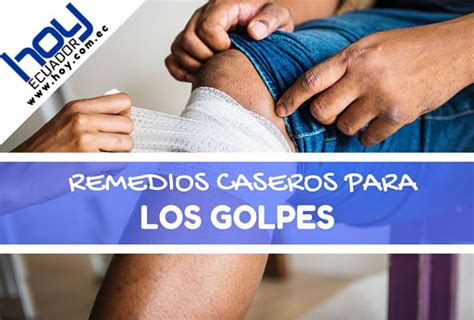 Remedios Caseros Para Golpes En La Cabeza Legionclinical