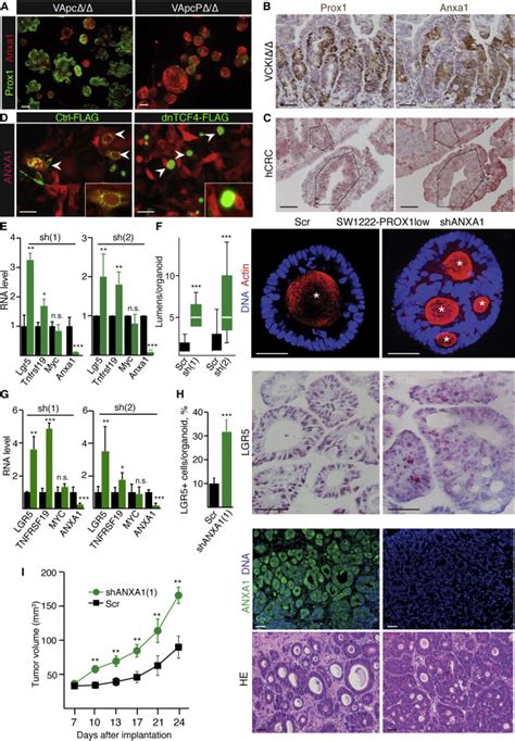 Anxa1 Silencing In Crc Leads To Elevated Stem Cell Activity And Tumor