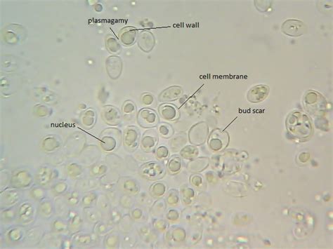 Yeast In Urine Under Microscope