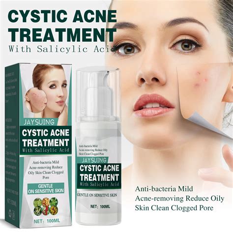 Cystic Acne Spot Treatment Hormonal Acne Treatment For Face，back And