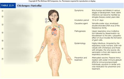 Chickenpox Varicella Diagram Quizlet