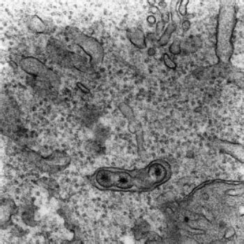 Retrovirus, Ultrathin Section and TEM | Cell Structure Lab