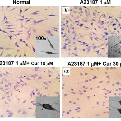 The β hexosaminidase releases stimulated by A23187 on RBL 2H3 cells a