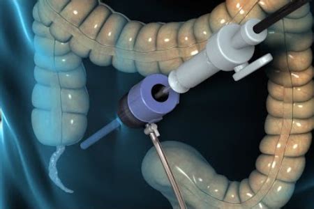 Appendicitis Surgery Cost in India