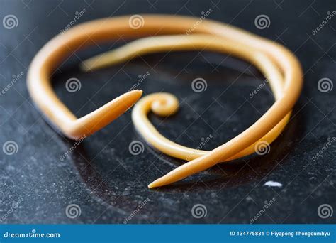 Ascariasis Is A Disease Caused By The Parasitic Roundworm Ascaris