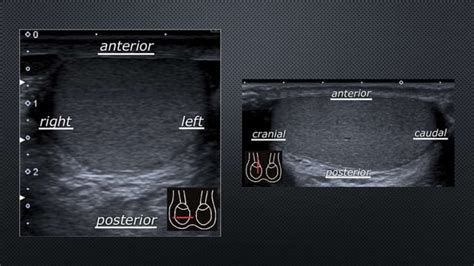 ULTRASOUND SCROTUM PPT