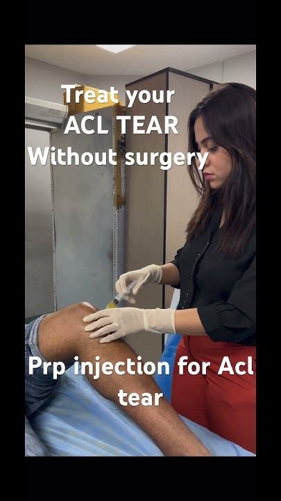 Treat Your Acl Tear Without Surgery Partial Acl Tear Can Be Treated