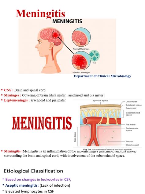 how to pronounce meningitis