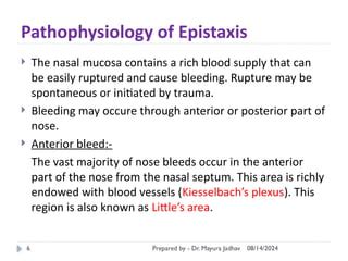 Epistaxis.pptx bleeding through nose know the treatment | PPT