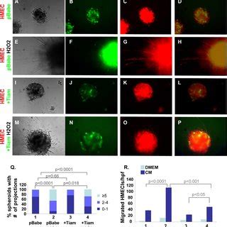 Upregulation Of Tiam1 In Senescent RMF Cells Inhibits The Invasion And