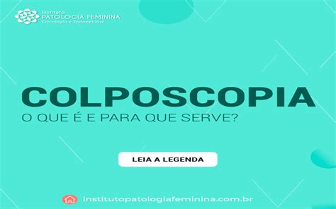 Colposcopia O Que E Para Que Serve Instituto Patologia Feminina